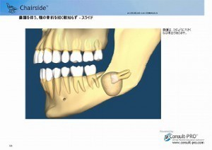 XEem炸_y[W_5