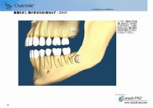 XEem炸_y[W_3