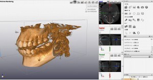 XN[Vbg 2015-06-26 14.32.30