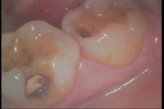 PICT0093.JPG