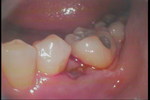 PICT0279.JPG
