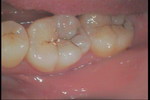 PICT0389.JPG