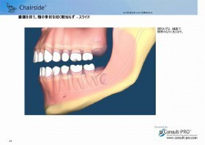 XEem炸_y[W_2