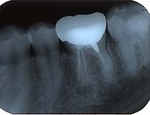 roentgen-01.jpg