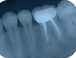 roentgen-03.jpg